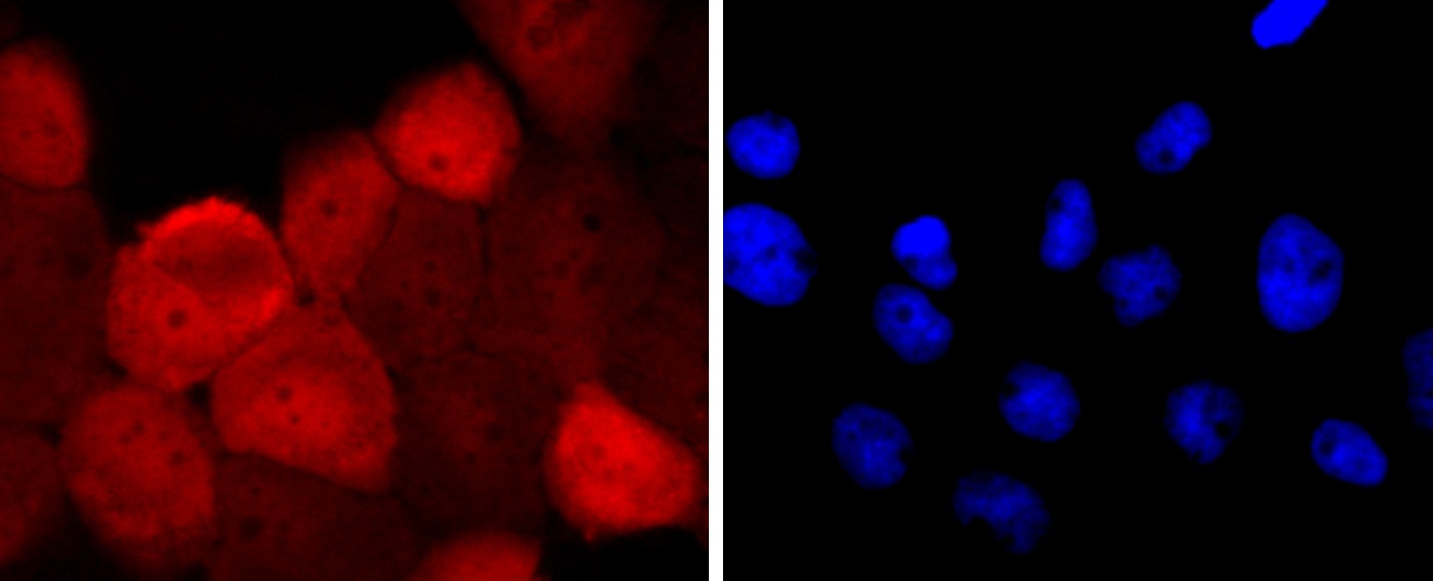 Anti-S100A6 Antibody (9N771)
