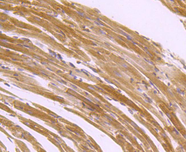 Anti-ATP2A2 Antibody (2R687)