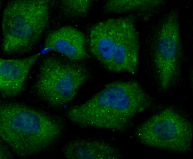Anti-Septin 2 Antibody (7L577)