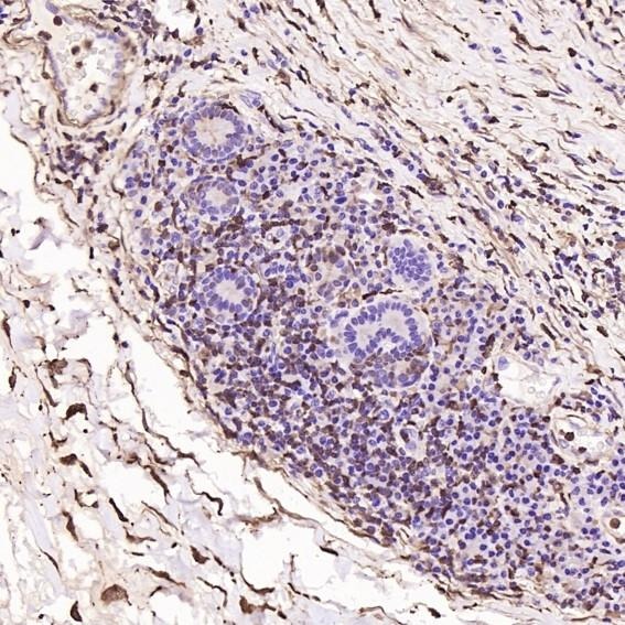 Anti-S100A4 Antibody (9W585)