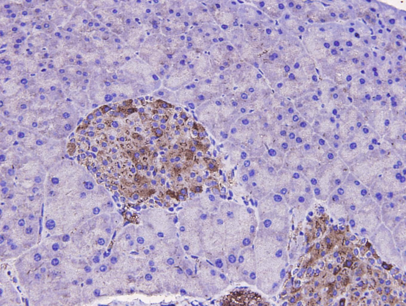 Anti-Sequestosome-1 Antibody (4X151)