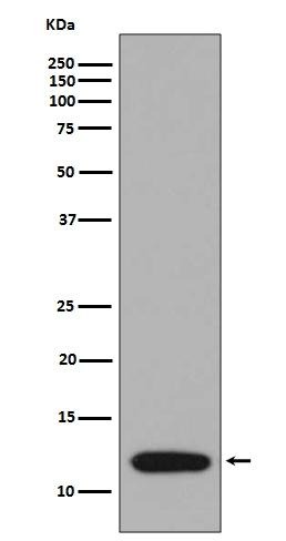 Anti-S100A4 Antibody (9W585)