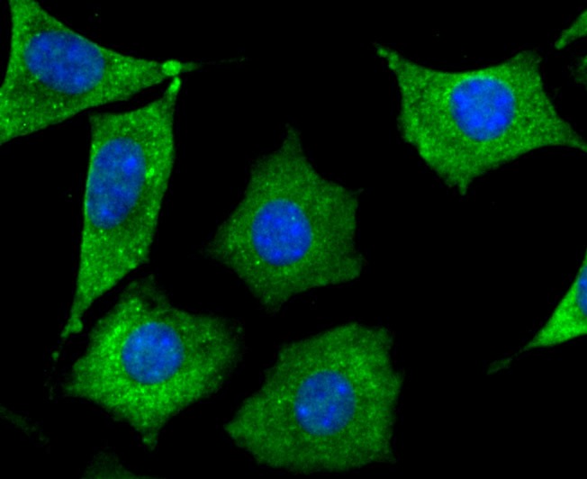 Anti-Septin 2 Antibody (7L577)