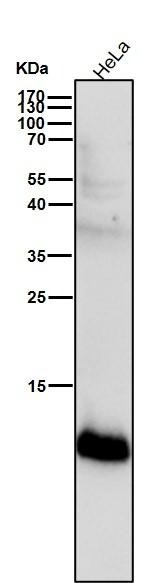 Anti-S100A4 Antibody (9W585)