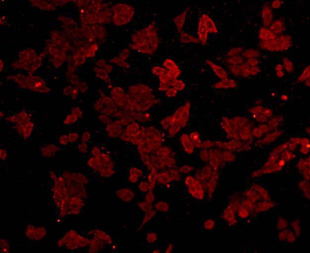 Anti-Sequestosome-1 Antibody (4X151)
