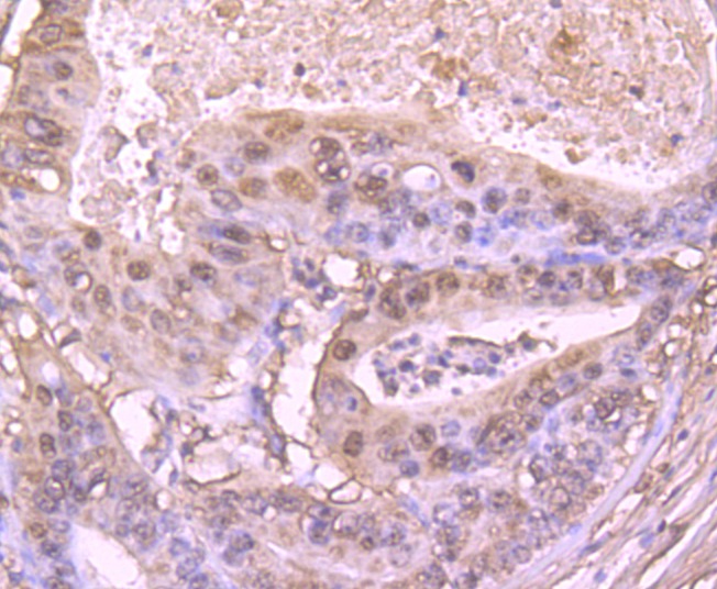 Anti-S100A6 Antibody (9N771)