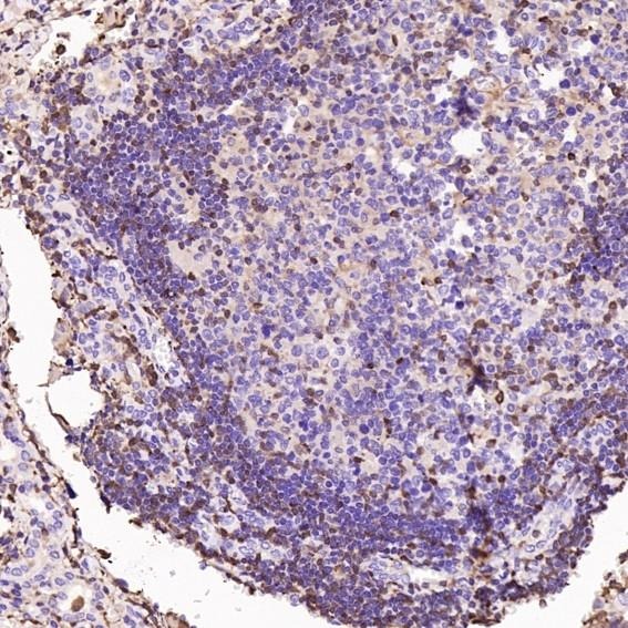 Anti-S100A4 Antibody (9W585)