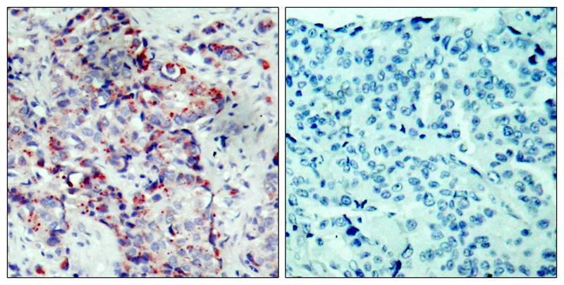 Anti-Phospho-MKK4 (Ser80) Polyclonal Antibody