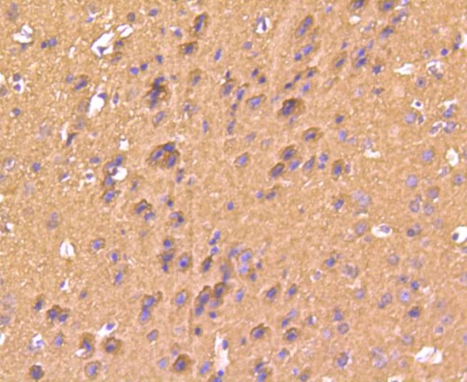 Anti-S100B Antibody (4A182)