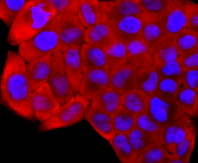 Anti-S100A6 Antibody (9N771)