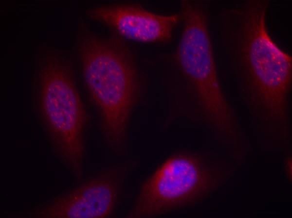 Anti-Phospho-MKK4 (Ser80) Polyclonal Antibody