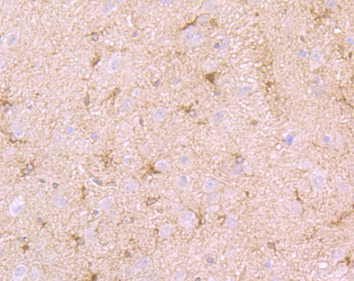 Anti-Septin 2 Antibody (7L577)