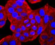 Anti-ATP2A2 Antibody (2R687)