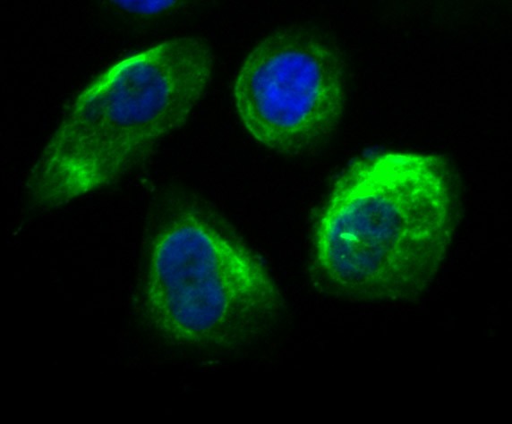 Anti-Securin Antibody (7P480)
