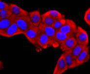 Anti-S100A9 Antibody (9D154)