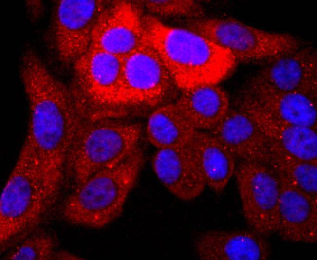 Anti-S100P Antibody (6W876)