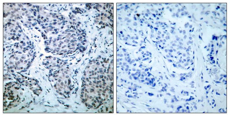 Anti-Phospho-MKK4 (Thr261) Polyclonal Antibody