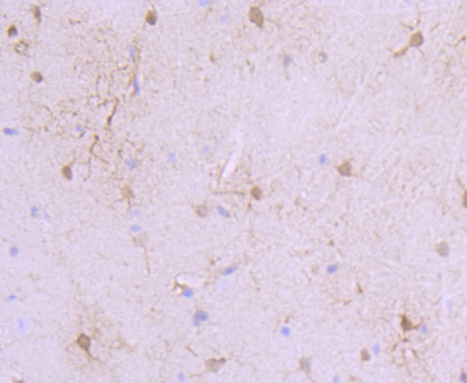 Anti-S100A6 Antibody (9N771)