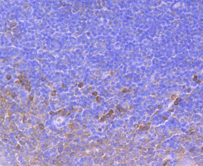 Anti-ATP2A2 Antibody (2R687)