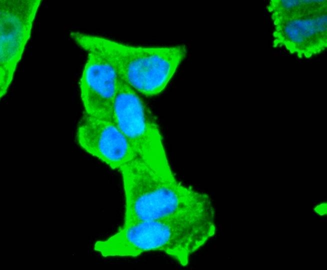 Anti-S100B Antibody (4A182)