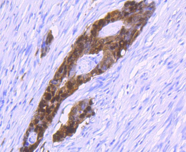Anti-S100P Antibody (6W876)