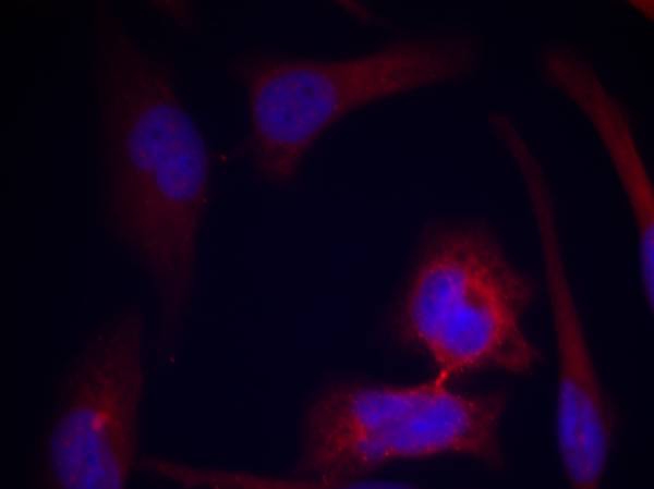 Anti-Phospho-S6 Ribosomal Protein (Ser235) Polyclonal Antibody