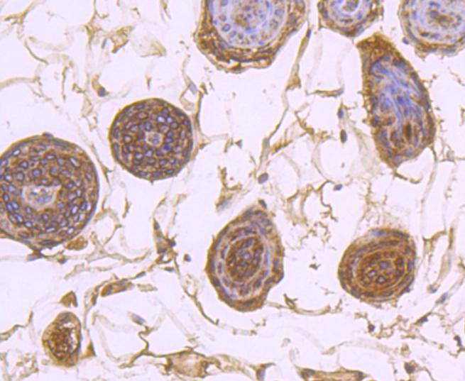 Anti-ATP2A2 Antibody (2R687)