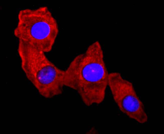 Anti-S100A9 Antibody (9D154)