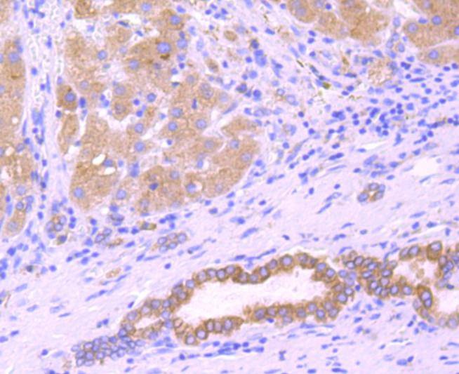 Anti-ATP2A2 Antibody (2R687)