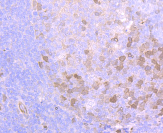Anti-Securin Antibody (7P480)