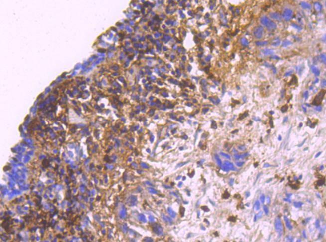 Anti-S100A9 Antibody (9D154)