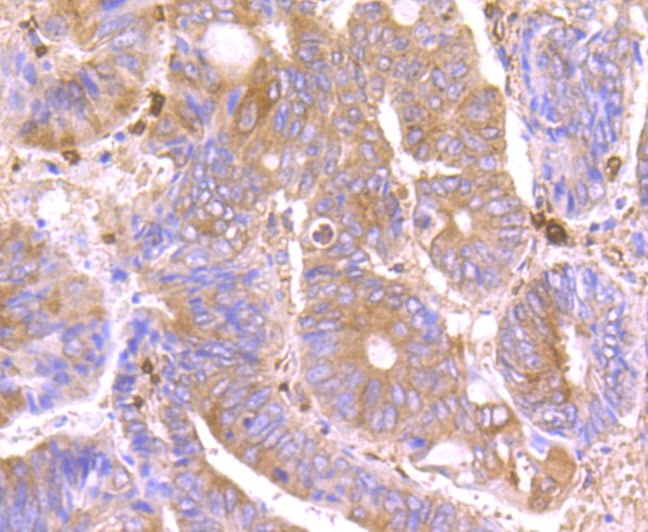 Anti-Septin 2 Antibody (7L577)