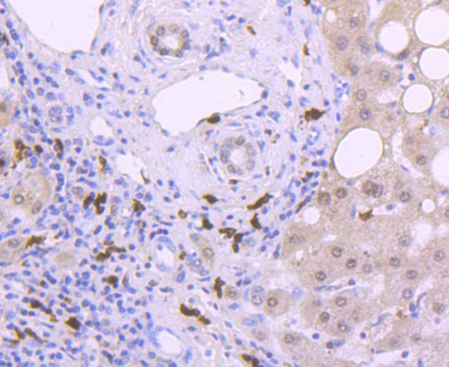 Anti-S100A9 Antibody (9D154)