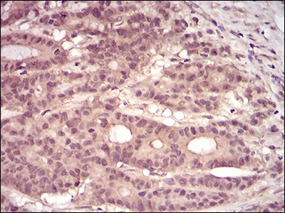 Anti-PKN1 Antibody (9Q867)