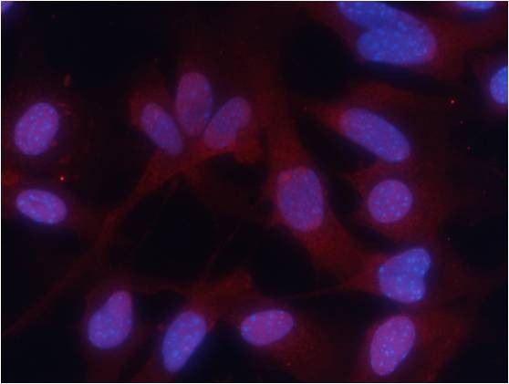 Anti-Phospho-PKM (Ser37) Polyclonal Antibody