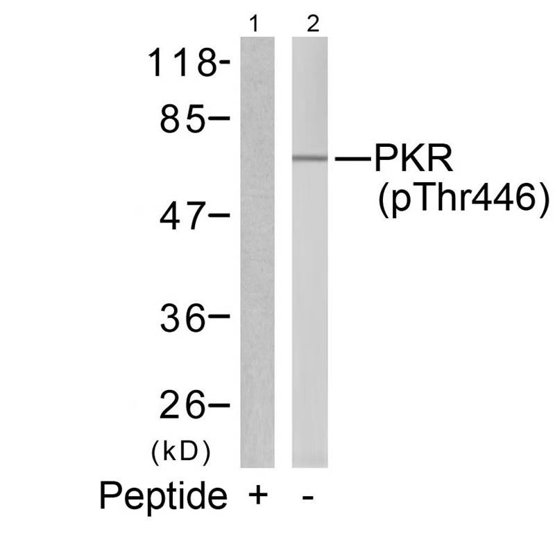 Anti-Phospho-EIF2AK2 (Thr446) Polyclonal Antibody