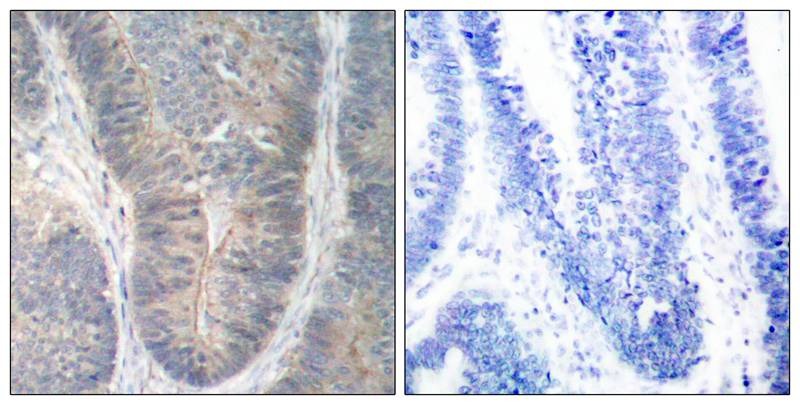 Anti-Phospho-EIF2AK2 (Thr451) Polyclonal Antibody