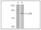 Anti-Phospho-EIF2AK2 (Thr446) Polyclonal Antibody 2