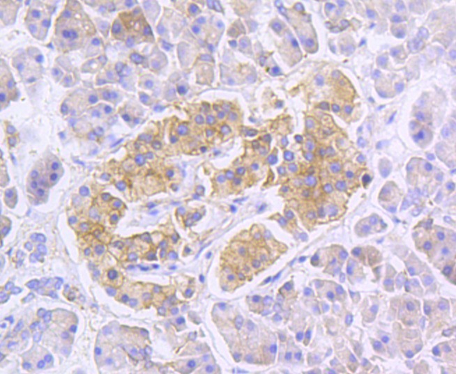 Anti-RALBP1 Antibody (4R123)