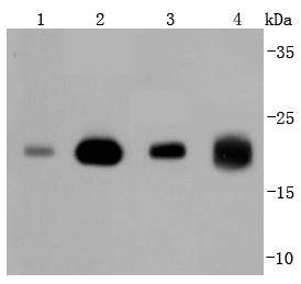 Anti-NRAS Antibody (5T588)