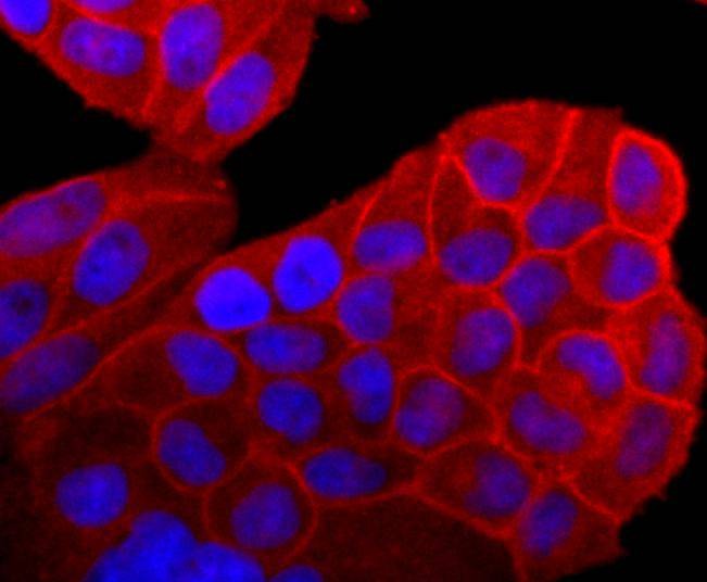 Anti-NRAS Antibody (5T588)