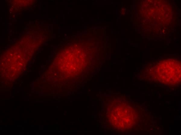 Anti-Phospho-RB1 (Ser780) Polyclonal Antibody