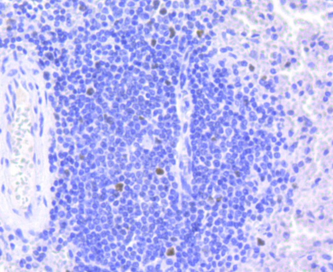 Anti-RB1 Antibody (6K434)