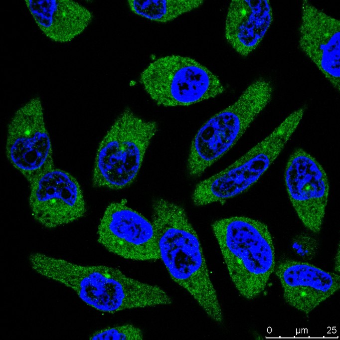 Anti-PIEZO1 Antibody (9P32)