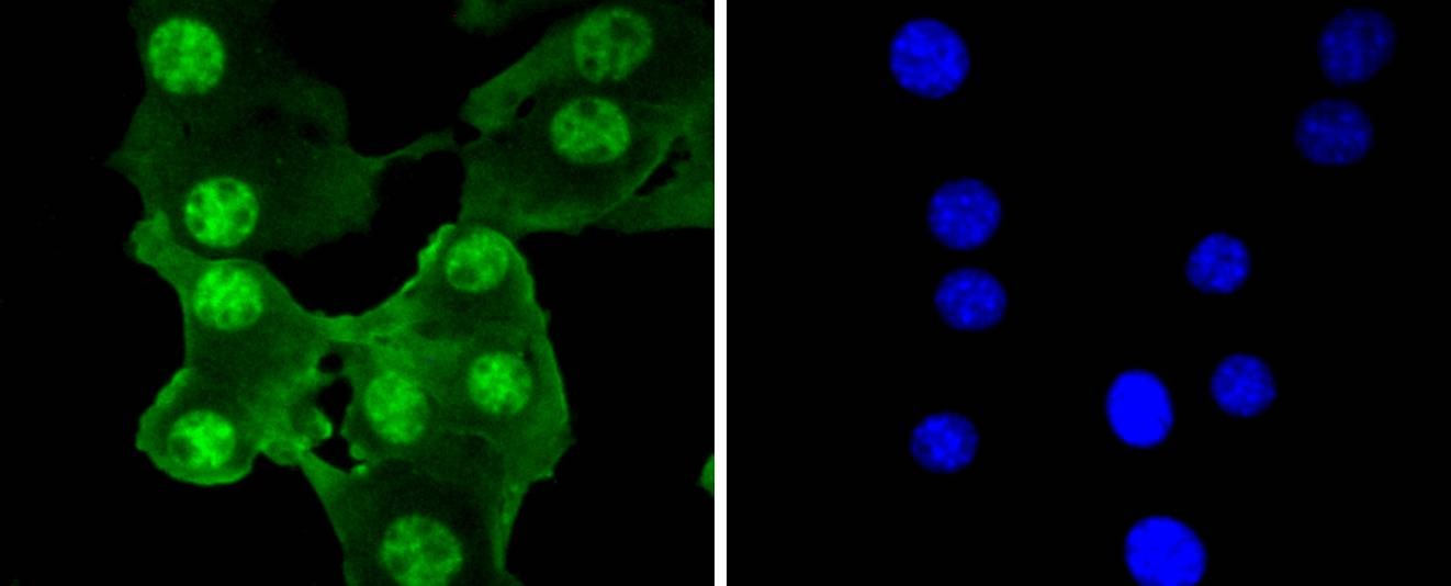 Anti-PRP19 Antibody (7U313)
