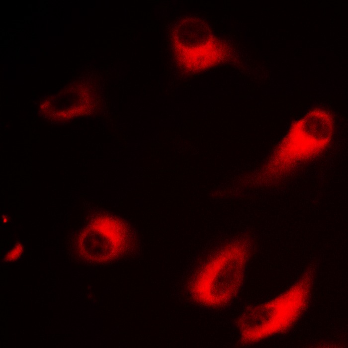 Anti-Phospho-Rabphilin 3A (Ser237) Polyclonal Antibody 2