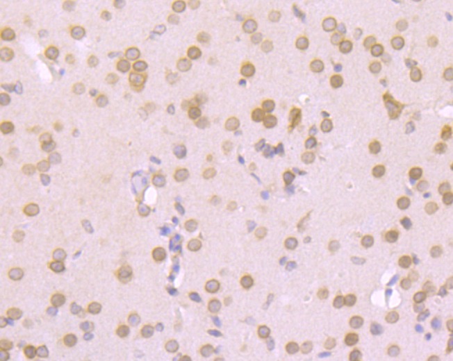 Anti-RanGAP1 Antibody (8X592)