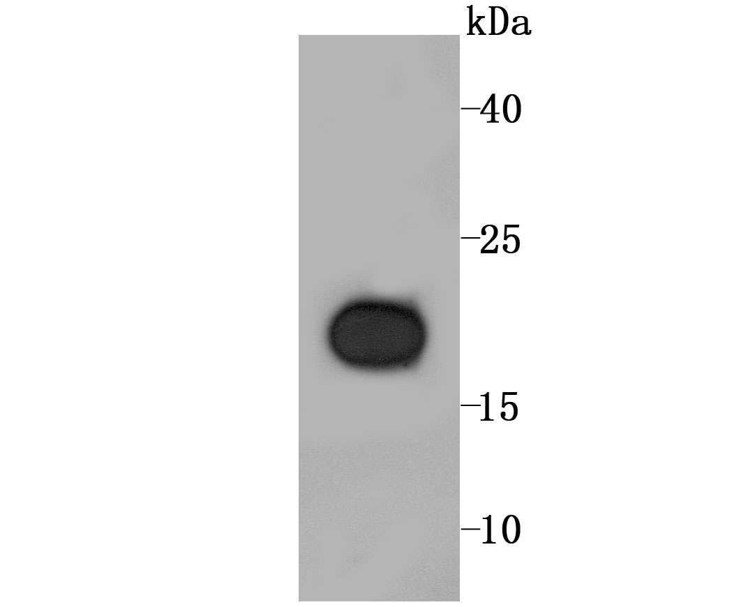 Anti-RBP4 Antibody (2C142)