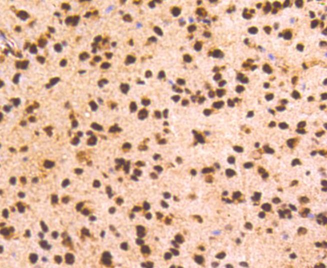 Anti-PRP19 Antibody (7U313)