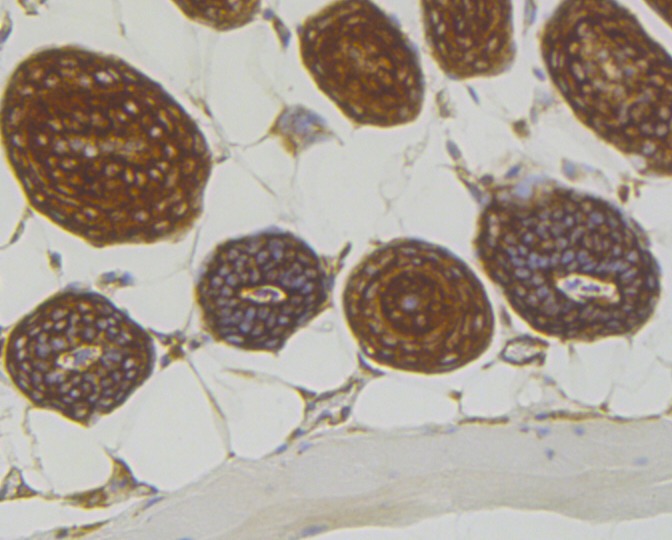 Anti-Rack1 Antibody (8C519)